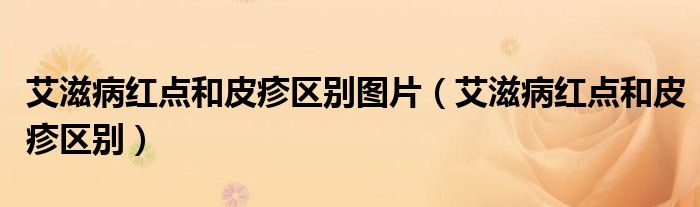艾滋病红点和皮疹区别图片(艾滋病红点和皮疹区别)